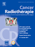 Cancer radiothérapie