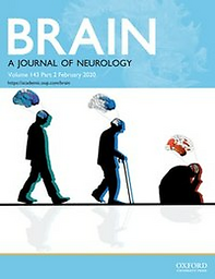 Brain : a journal of neurology
