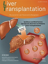 Liver transplantation